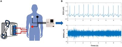 Evaluation of autonomic nervous system activity in intradialytic hypotension using entropy and skin sympathetic nerve activity